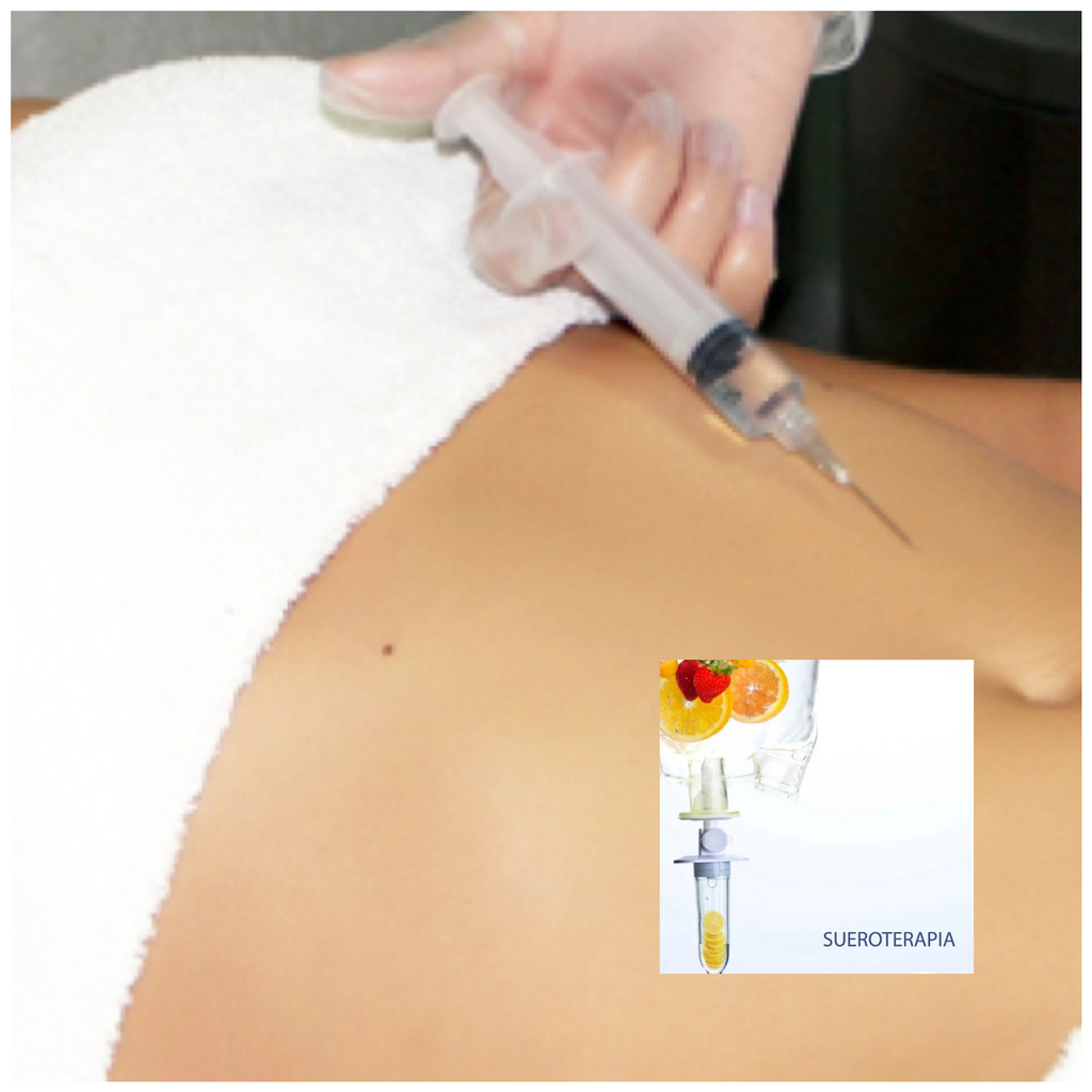 SueroTerapia Adelgazante