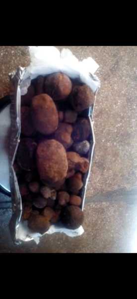 Vendo cálculos biliares y anguilas