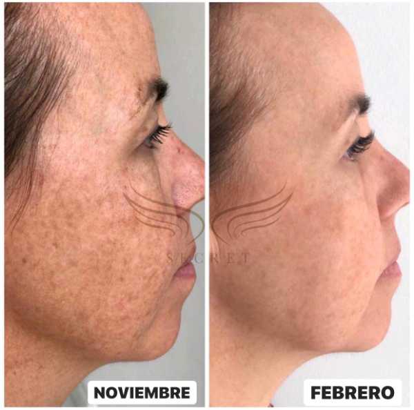 Problemas de piel, pelo o uñas??