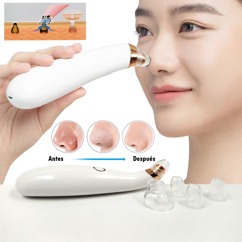 REMOVEDOR ESPINILLAS PUNTOS NEGROS CUIDADO PIEL ROSTRO